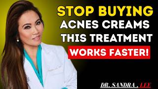 30 Day Acne Treatment Challenge - 7 Methods Real Results | Dr. Sandra Lee