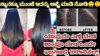 ಒಂದೇ ದಿನದಲ್ಲಿ dandruff ಮಾಯ ಆಗುತ್ತೆ//ಕೂದಲು ಚೆನ್ನಾಗಿ ಬೆಳೆ ಬೇಕು ಅಂದ್ರೆ?#dandruf@dishanthkannadavlogs