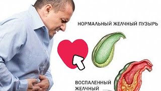 Лечение холецистита и панкреатита. Фестал драже