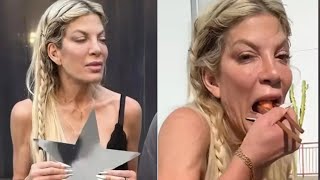 Leaked Before & After Photos of Celebs Suffering From Ozempic Face