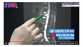 [KNN건강튜브] 3/18(목) \