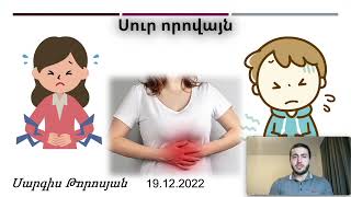 Սուր որովայն / Որովայնային ցավեր / Փորի ցավ, բորբոքում, խոց, քար, անանցանելիություն /Abdominal pain