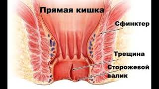 Чистотел и здесь помог