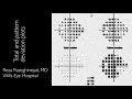 5-  Visual field interpretation (Total and pattern deviations in Humphrey perimeter)