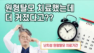 원형탈모 치료했는데 더 커졌다고??(난치성 원형탈모 치료기간)