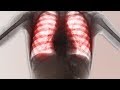 Download A Boy Ate 3 Laundry Pods. This Is What Happened To His Lungs. In Mp4 3Gp Full HD Video