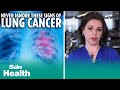 I'm a doctor, NEVER ignore these lung cancer symptoms