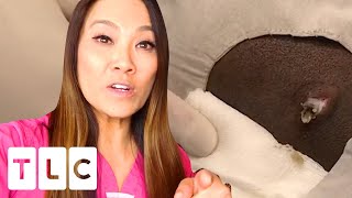"It Is Actually A Little Bit Bigger": A Cyst In Man's Neck Ready To Burst | Dr. Pimple Popper