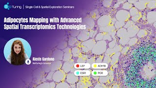 EP5: Adipocytes Mapping with Advanced Spatial Transcriptomics Technologies