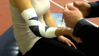 Elbow Hyperextension