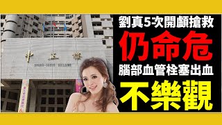 #搶救28天/劉真5次開顱搶救仍命危 血管栓塞出血不樂觀