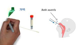 Easy Nat Covid-19 Test