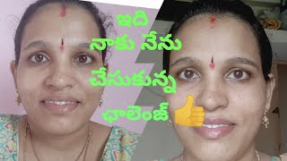 #Beautytips #sandyuniquethings మీకు వున్నా మొటిమలు,మచ్చలు తగ్గే సూపర్ టిప్/ మొటిమలు తగ్గే అధ్బుతం