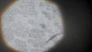 yeast cells dividing under the microscope (baker's yeast)