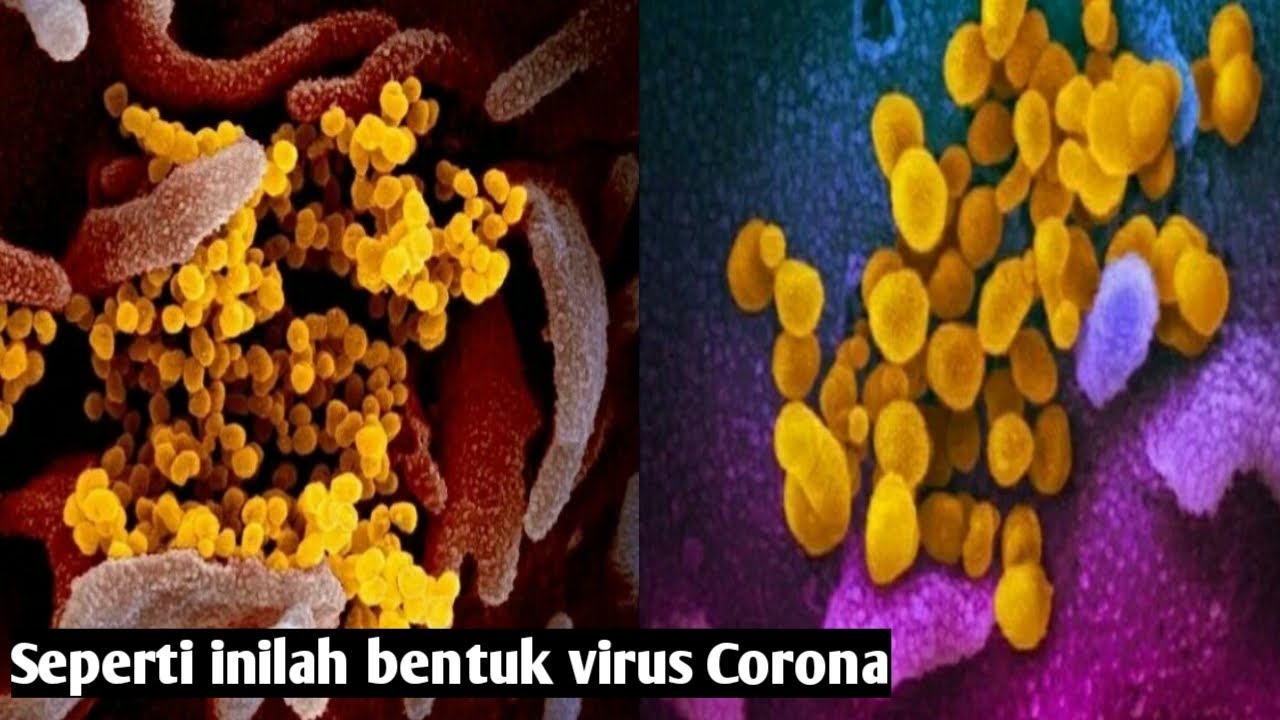 Seperti Inilah Bentuk Virus Corona - YouTube