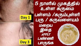 முகத்தில் உள்ள சரும பிரச்சனை எல்லாம் நீங்க இது போதும் | natural beauty tips in tamil | face tips