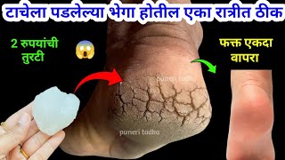 फक्त 2 रुपयाची तुरटी वापरा टाचेला पडलेल्या भेगा रात्रीत ठीक होतील 😱 Marathi kitchen tips / recipe