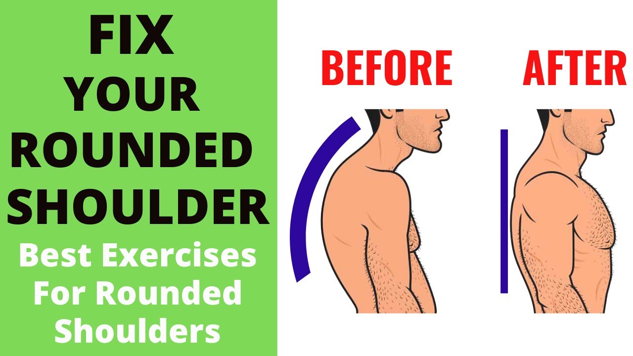 How To Fix Rounded Shoulders PERMANENTLY | 4 Easy Exercises | Improve ...