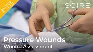 Pressure Wounds: Wound Assessment