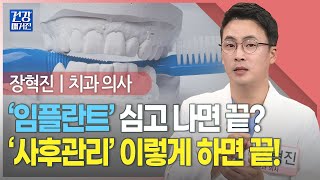 [#건강앤한경] 임플란트, 탈 없이 오래 사용하려면ㅣ임플란트, 사후관리 4대 기본 도구ㅣ전신 건강 첫 단추 ‘치아 건강’