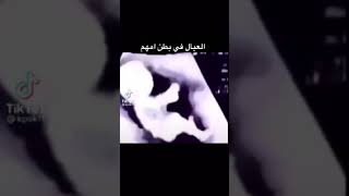 الطفل عندما يصير درباوي