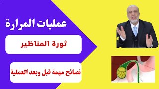 عمليات المرارة: د علي بطيخ يشرح عملية المرارة بالمنظار وبالجراحة ونصائح للمريض قبل وبعد العملية