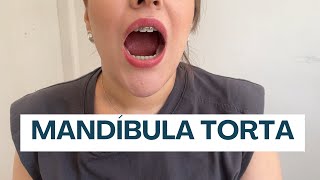 A MANDÍBULA DELA NÃO FECHA RETO