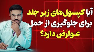 آیا کپسول های زیر جلد برای جلوگیری از حمل عوارض دارد؟| دکتور قیس نیکزاد