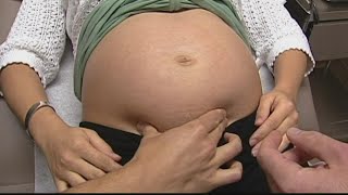 Study has doctors urging pregnant women to take additional COVID-19 precautions