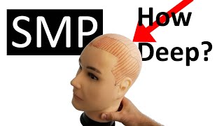 Scalp Skin Thickness for SMP (How Deep)