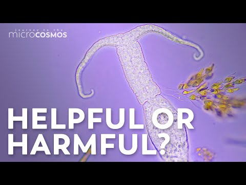 Is paramecium Good or bad?