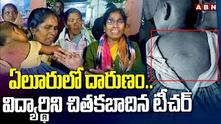 ఏలూరులో దారుణం..విద్యార్థిని చితకబాదిన టీచర్ | Teacher Beats Student In School At Chekkapalli |ABN