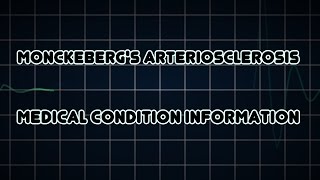 Monckeberg's arteriosclerosis (Medical Condition)