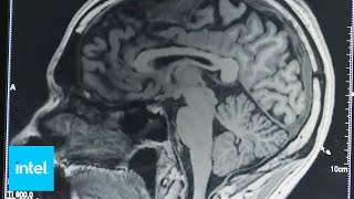 Mapping The Mind With AI | Intel