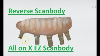 All on X Scanning with Reverse Scanbody