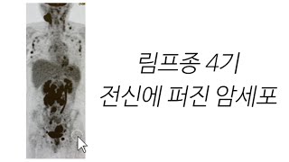 (4) 턱 밑 멍울이 보이면 당장 병원에 가시오