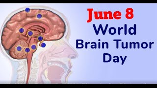 June 8- World Brain Tumor Day--ലോക മസ്തിഷ്ക മുഴ ദിനം