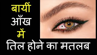 बायीं आँख में तिल होने का मतलब । Moles in Left eye and its meaning। Bai Aankh me til