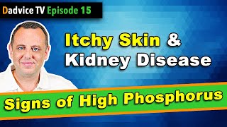 Itchy Skin & Chronic Kidney Disease - A sign of low kidney function & high phosphorus