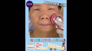 :Deepn 閃粉紅冰雪拉皮機 + 初生線 :: DEEPN Multipolar  FACE Beauty Device 5.0 + Tight Up  :: 1 | deerbydeer.com