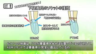 【国家試験対策編】KBMソケットのポイント　#義肢装具 #リハビリ #理学療法 #国家試験 #解説