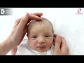 soft spots on newborn baby head fontanelle dr.seema gaonkar of cloudnine hospitals doctors circle