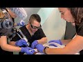 GETTING RID OF MY DEEP ACNE SCARS | PROFRACTIONAL LASER SKIN RESURFACING | Dr. Jason Emer