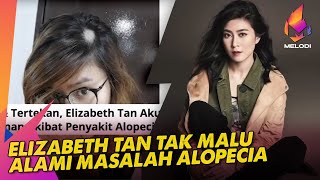 Elizabeth Tan Tak Malu Alami Masalah Alopecia  Melodi 2022