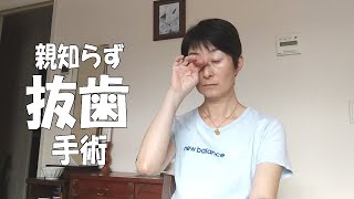 横向きで眠っている親知らずの抜歯【水平埋伏智歯】【抜歯手術】【50代】