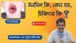 What is Tonsil | Treatment Options | Tushar Kanti Ghosh | Ghosh ENT Foundation | #tonsilitis