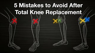 Don't Ruin Your Knee Replacement With These Common Errors