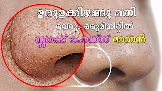 ഉരുളക്കിഴങ്ങു മതി വെറും ഒരുമിനിറ്റിൽ ബ്ലാക്ക് ഹെഡ്സ്‌ മാറാൻ