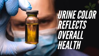 The top 6 urine colors and what they reveal about your health