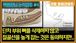 [박원장님 논리검증📌 #4] 단차부위 뼈를 삭제하지 않고 절골선을 높게 잡는 것은 저도 동의합니다만...ㅣ제가 박원장님께 드리고 싶은 말씀은...